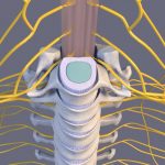 Vertebral Disc & Spinal Cord